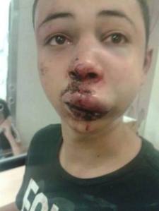 15-year old Tariq, cousin of recently murdered Muhammad Abu Khdeir (16), was beaten and abducted by Israeli police on Thursday. He was refused medical treatment for his broken nose and other injuries while in custody. Read the full article here: http://www.imemc.org/article/68330 